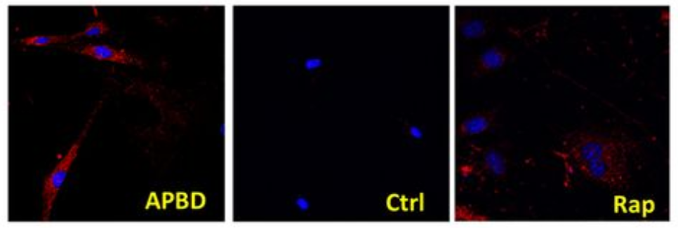 Representative images of glycogen staining in APBD, HC and APBD treated with rapamycin